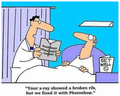 The latest technology in fixing broken ribs