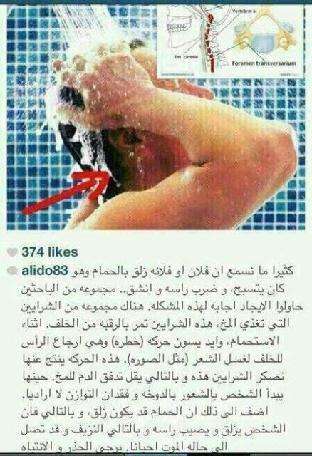 حركة خطيرة نقوم بهاأثناء الإستحمام و تؤدي إلى الوفاة في بعض الأحيان.