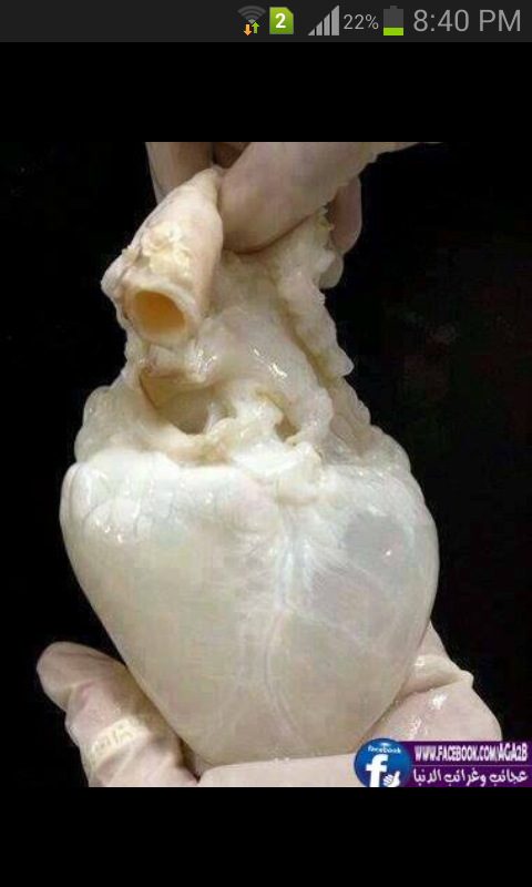 human heart without blood