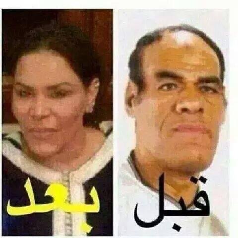 الفنانة #احلام قبل وبعد عمليات التجميل ههه