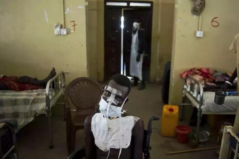 أفضل صور العالم لعام ٢٠١٤ حسب WSJ - شاب تعرض لاطلاق النار في وجهه وصدره ورقبته في جنوب السودان