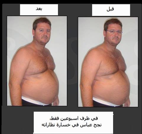 قصة نجاح في #تخسيس الوزن 