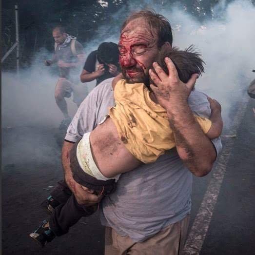 هذه الصورة ليست في مناطق الصراع بل على حدود المجر للاجىء سوري يحمي ابنه من هجوم الشرطة المجرية 