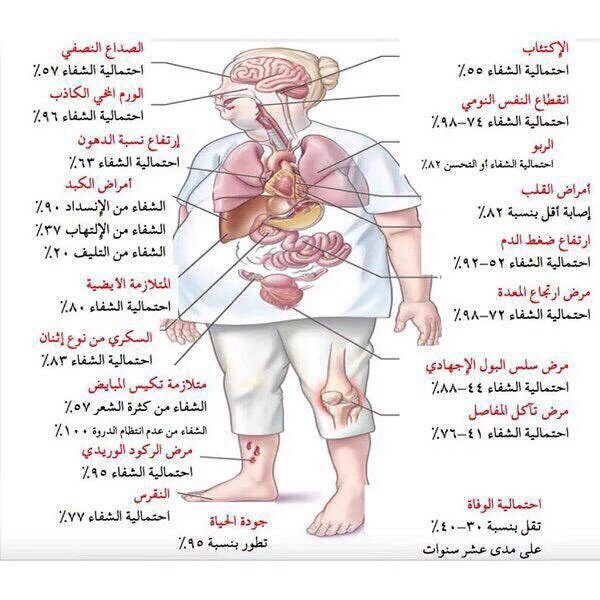 أمراض تختفي مع ال#تخسيس #انفوجرافيك #صحة