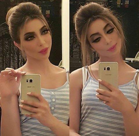 #دنيا_بطمة بعد تركيب وجه جديد #مشاهير