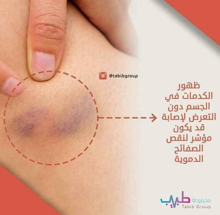 #معلومات طبية مهمة #صحة - صورة ١