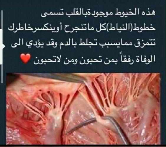 نياط القلب