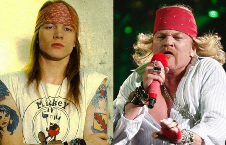 #مشاهير تغيرت أشكالهم بشدة مع تقدمهم بالعمر - Axl Rose