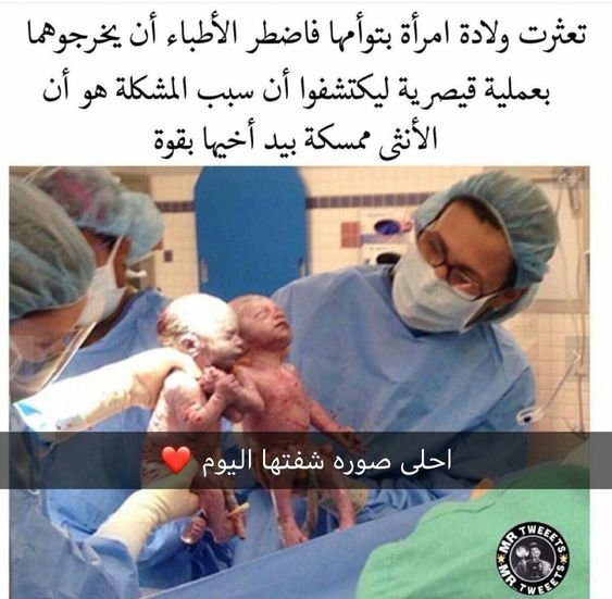 تعثرت ولادة إمرأة بتوأم والسبب كان غريبا