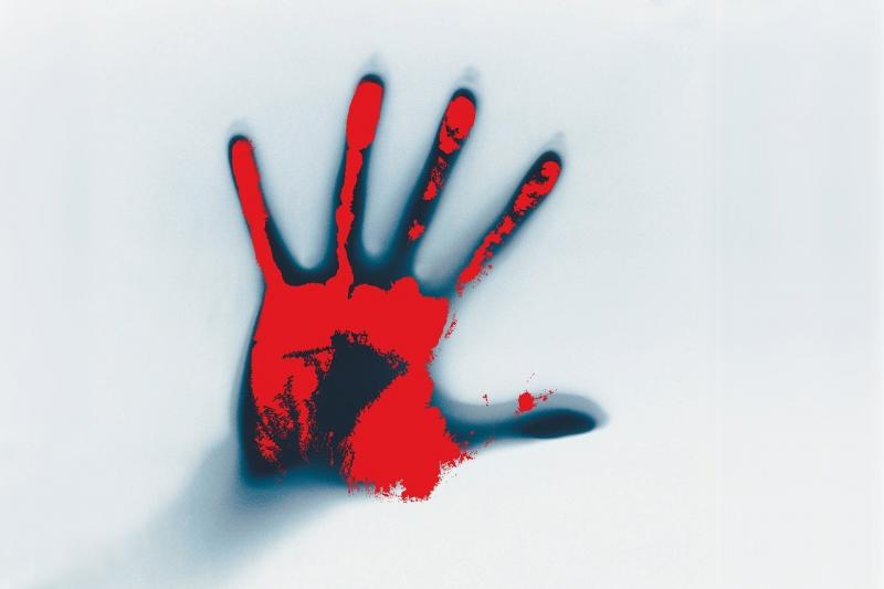 صور لـ #دموي #يد #حادث #جرح #دم #طخت